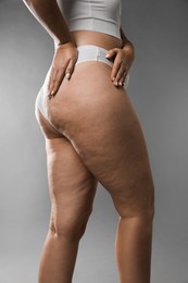 Woman with cellulite on grey background, closeup