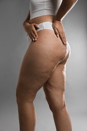 Photo of Woman with cellulite on grey background, closeup