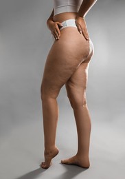 Photo of Woman with cellulite on grey background, closeup