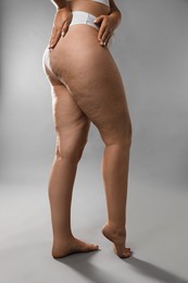 Photo of Woman with cellulite on grey background, closeup