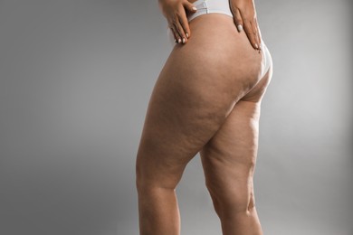 Photo of Woman with cellulite on grey background, closeup. Space for text