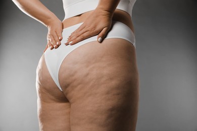 Woman with cellulite on grey background, closeup. Space for text