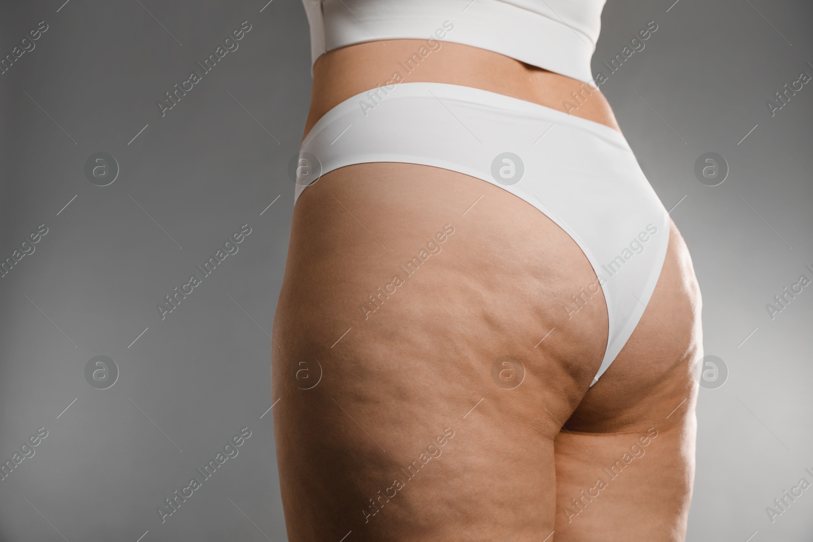 Photo of Woman with cellulite on grey background, closeup. Space for text