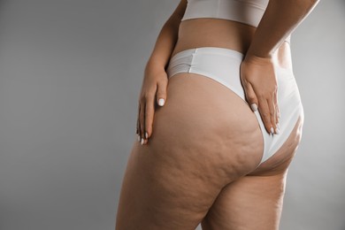 Woman with cellulite on grey background, closeup. Space for text