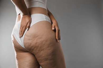 Photo of Woman with cellulite on grey background, closeup. Space for text