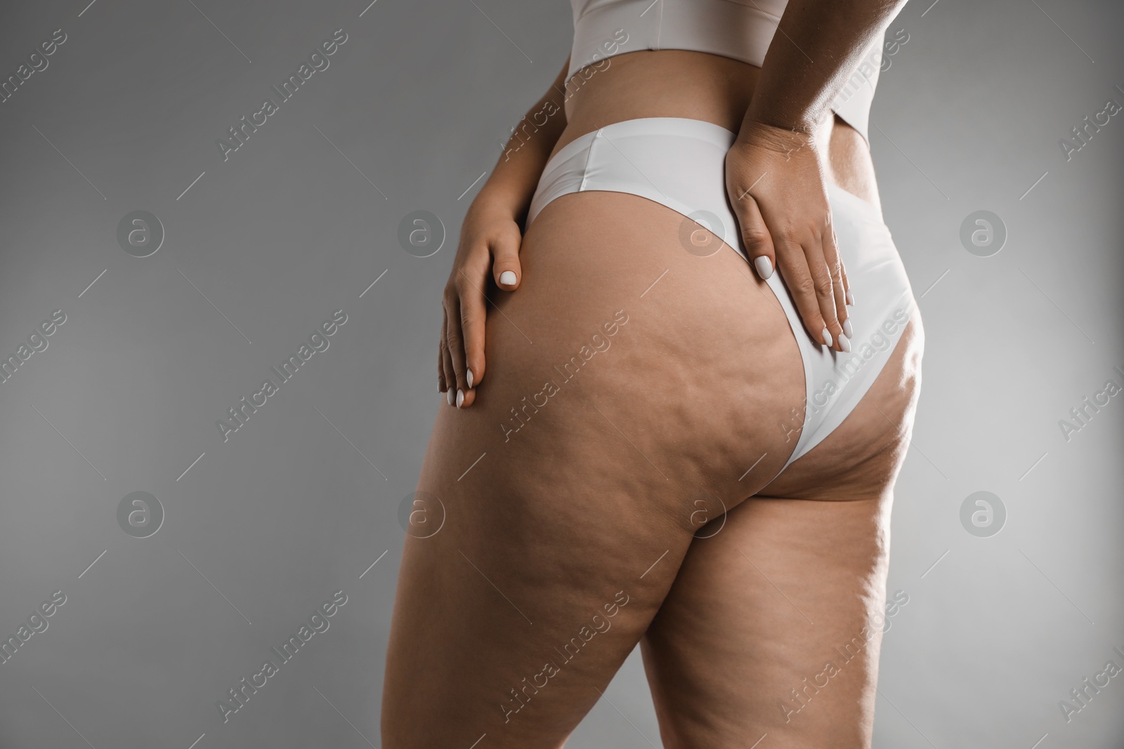 Photo of Woman with cellulite on grey background, closeup. Space for text