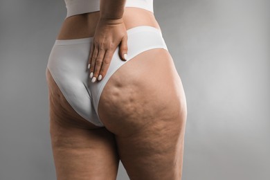 Photo of Woman with cellulite on grey background, closeup. Space for text