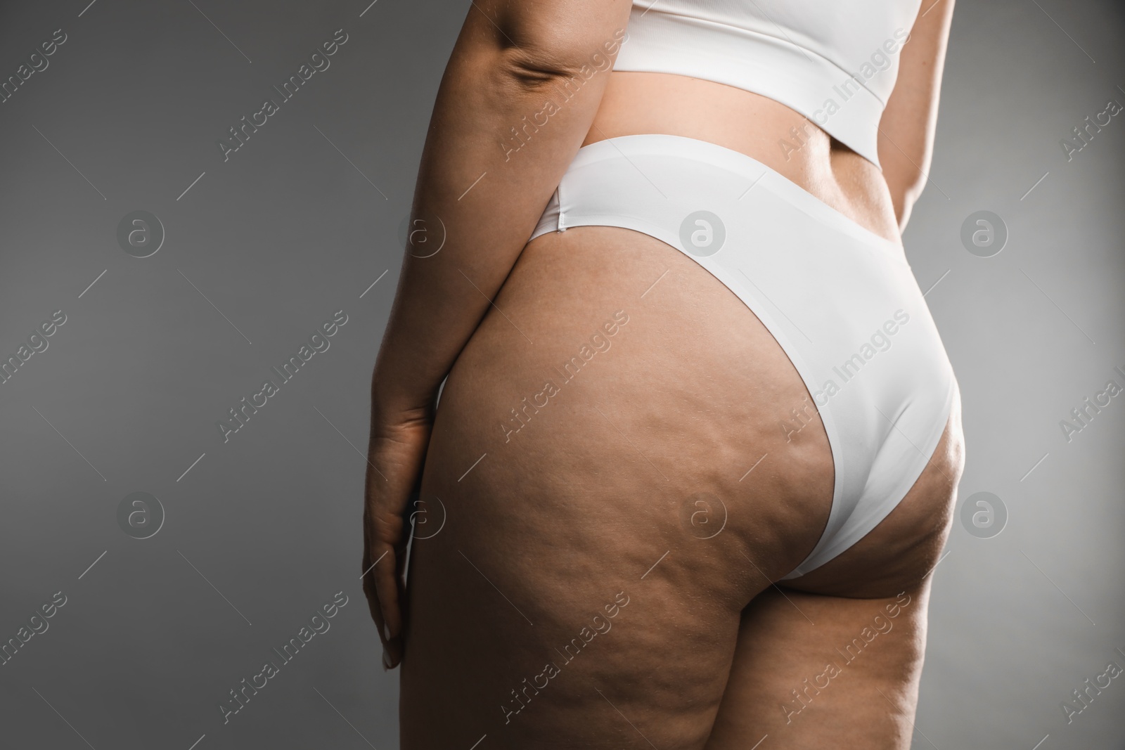 Photo of Woman with cellulite on grey background, closeup. Space for text