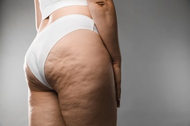 Woman with cellulite on grey background, closeup. Space for text