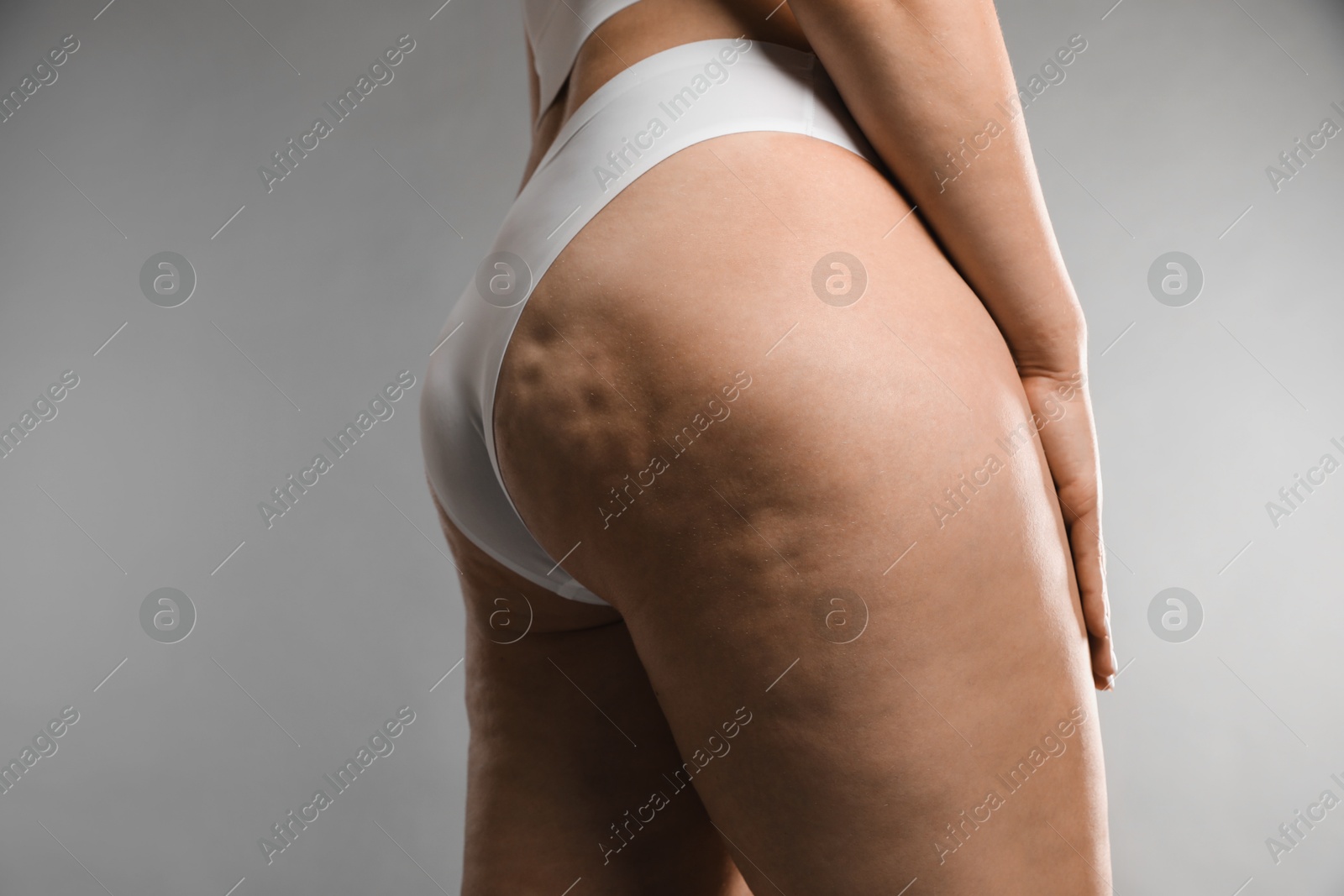 Photo of Woman with cellulite on grey background, closeup. Space for text