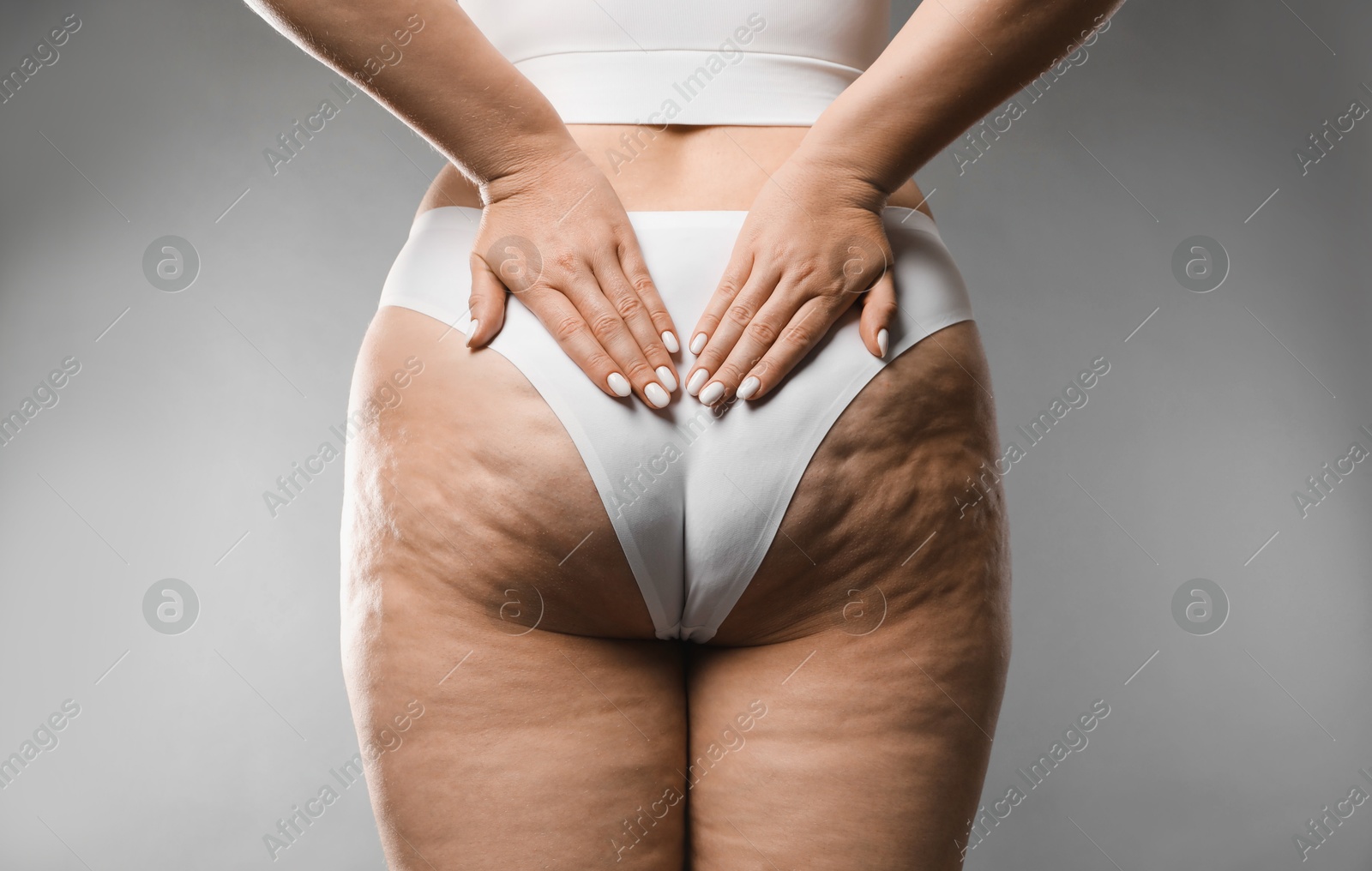 Photo of Woman with cellulite on grey background, closeup