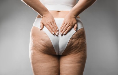 Photo of Woman with cellulite on grey background, closeup