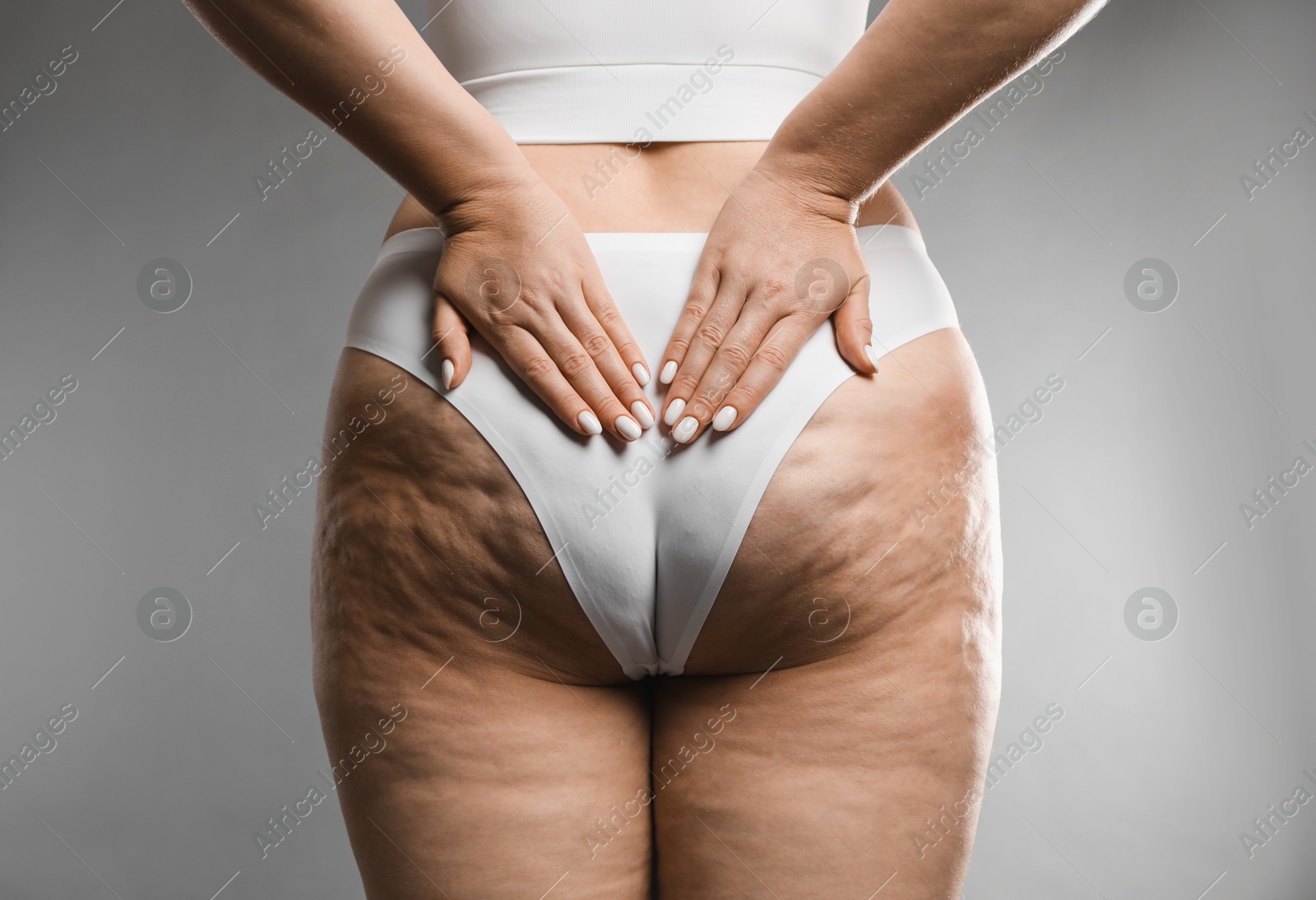 Photo of Woman with cellulite on grey background, closeup