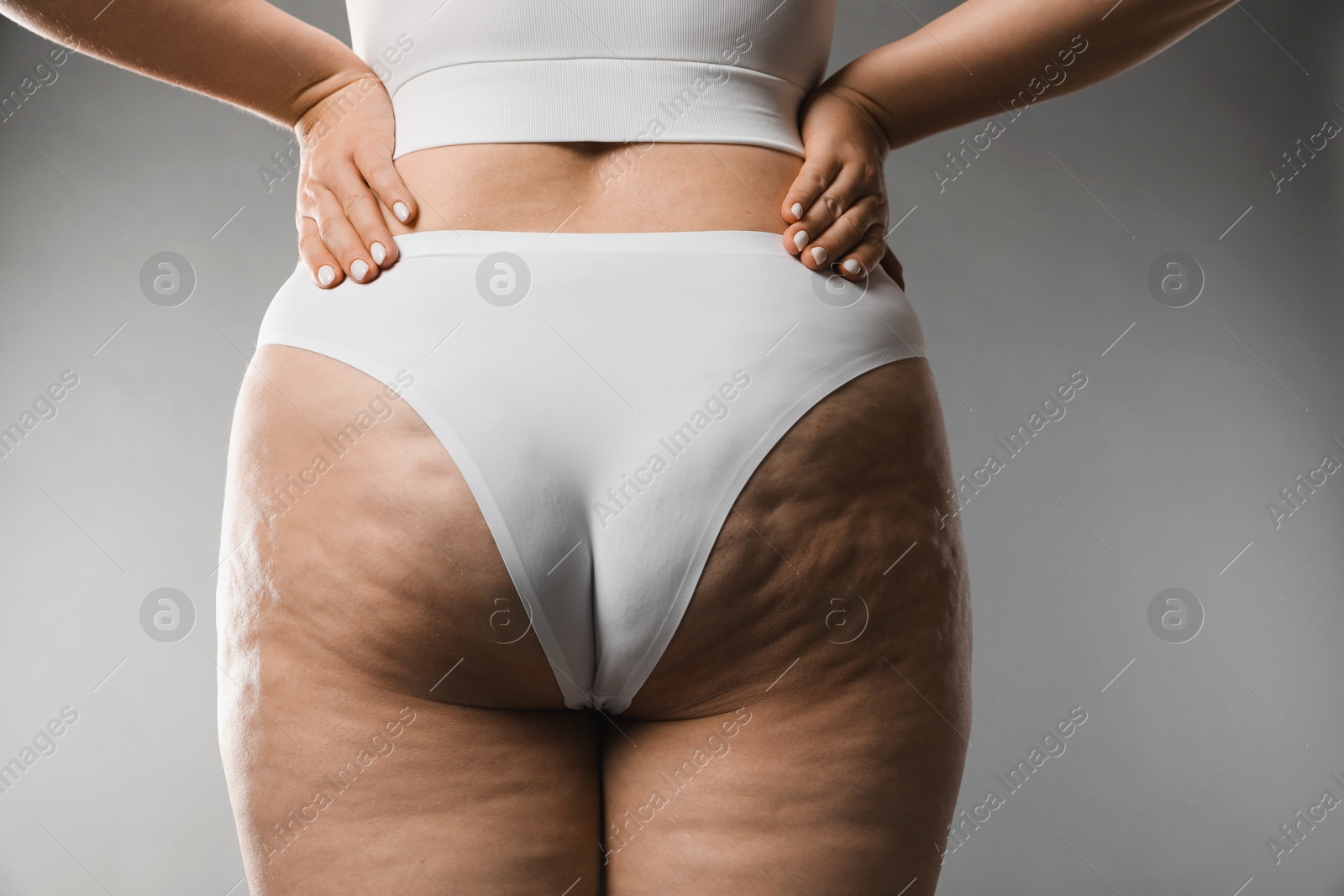 Photo of Woman with cellulite on grey background, closeup