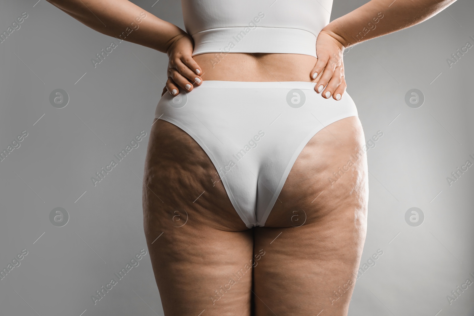 Photo of Woman with cellulite on grey background, closeup