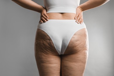 Woman with cellulite on grey background, closeup