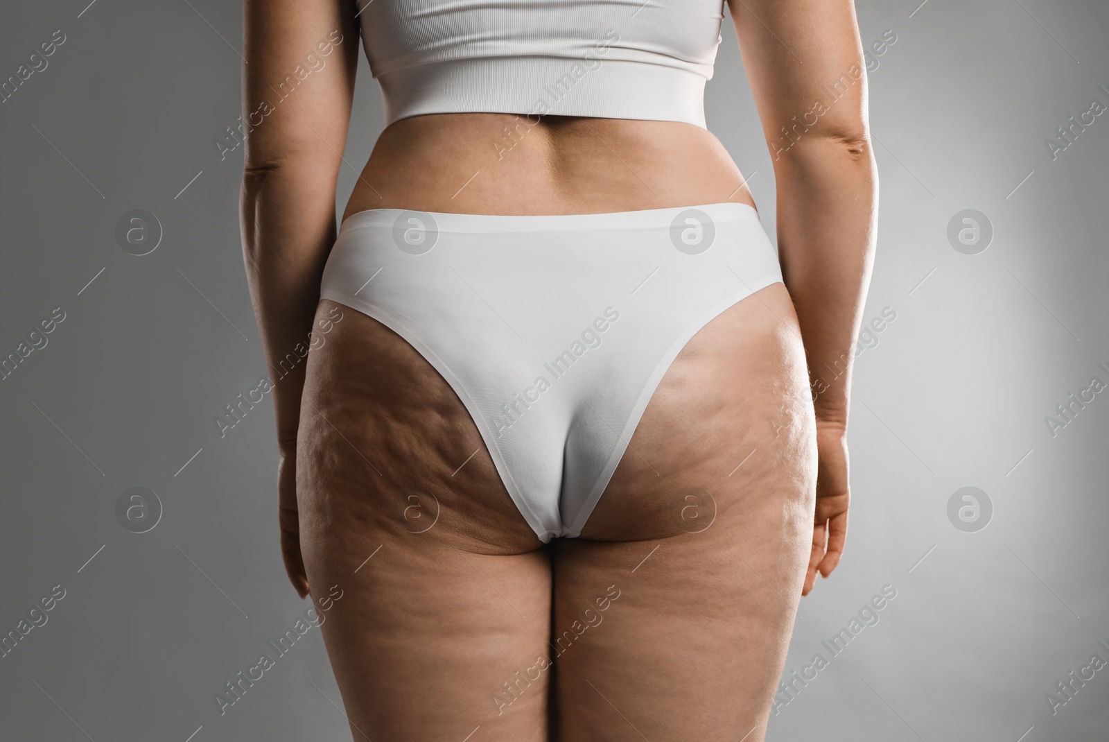 Photo of Woman with cellulite on grey background, closeup