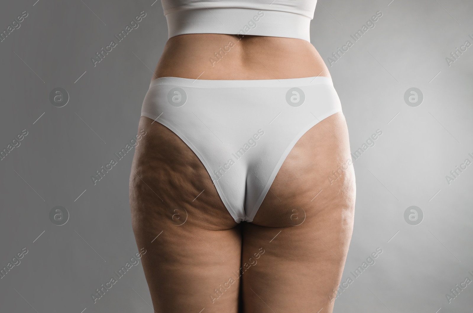 Photo of Woman with cellulite on grey background, closeup