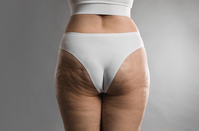 Woman with cellulite on grey background, closeup