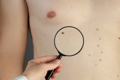 Dermatologist examining patient's birthmark with magnifying glass, closeup