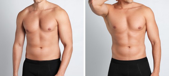 Man showing body before and after weight loss on white background, closeup