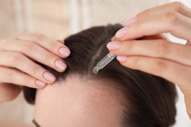 Hair loss problem. Woman applying serum onto hairline indoors, closeup