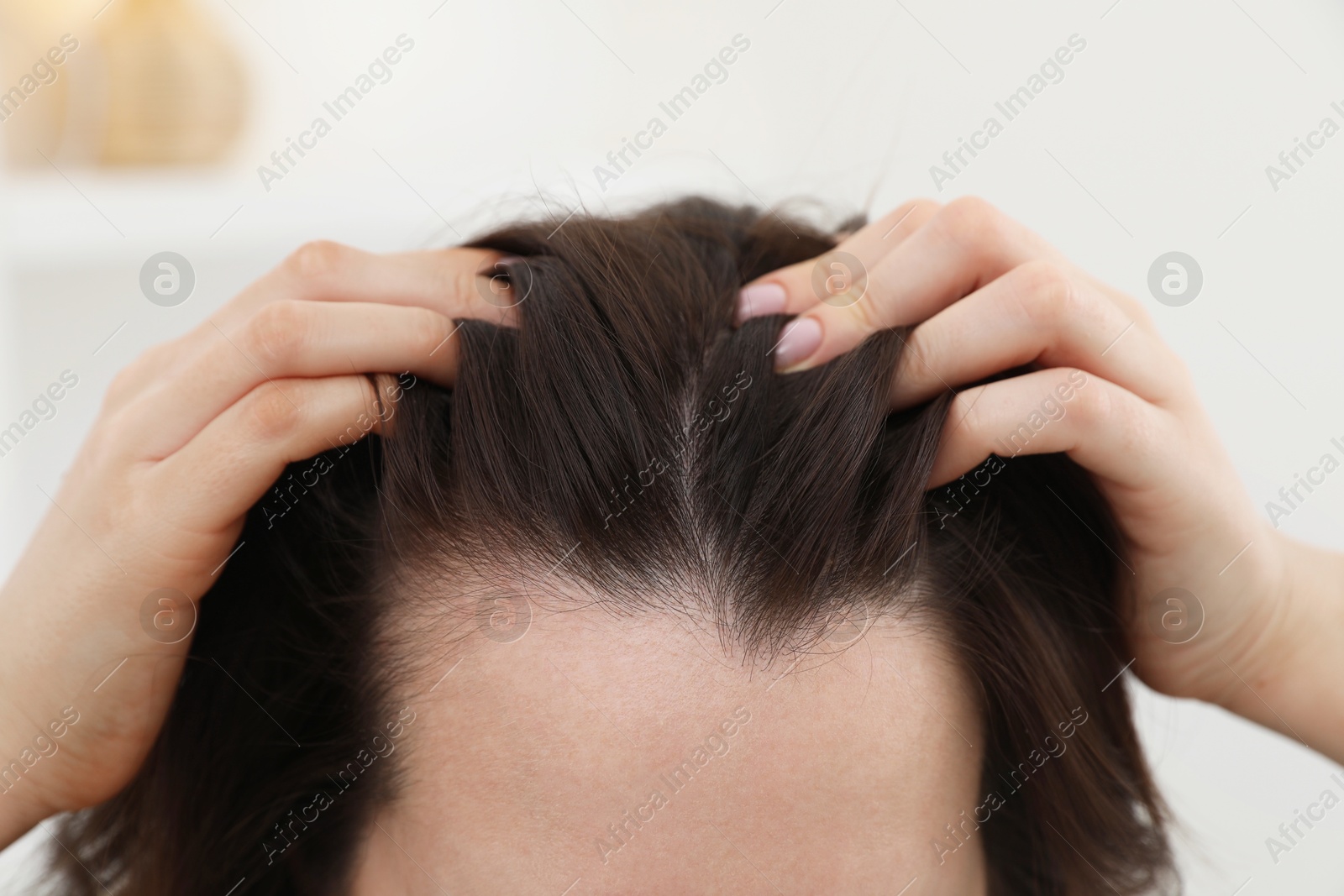 Photo of Woman with hair loss problem at home, closeup