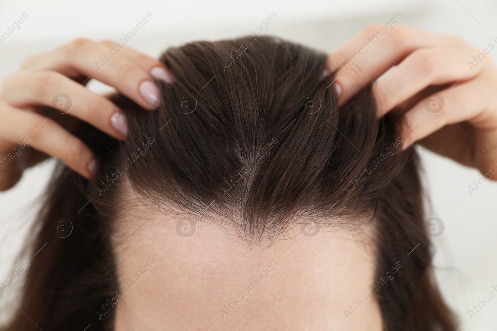 Photo of Woman with hair loss problem at home, closeup