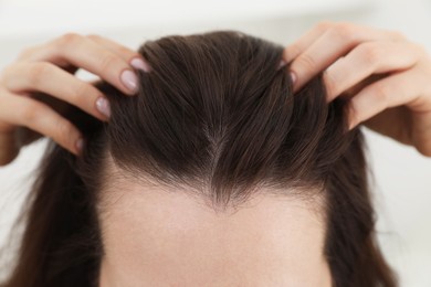 Woman with hair loss problem at home, closeup