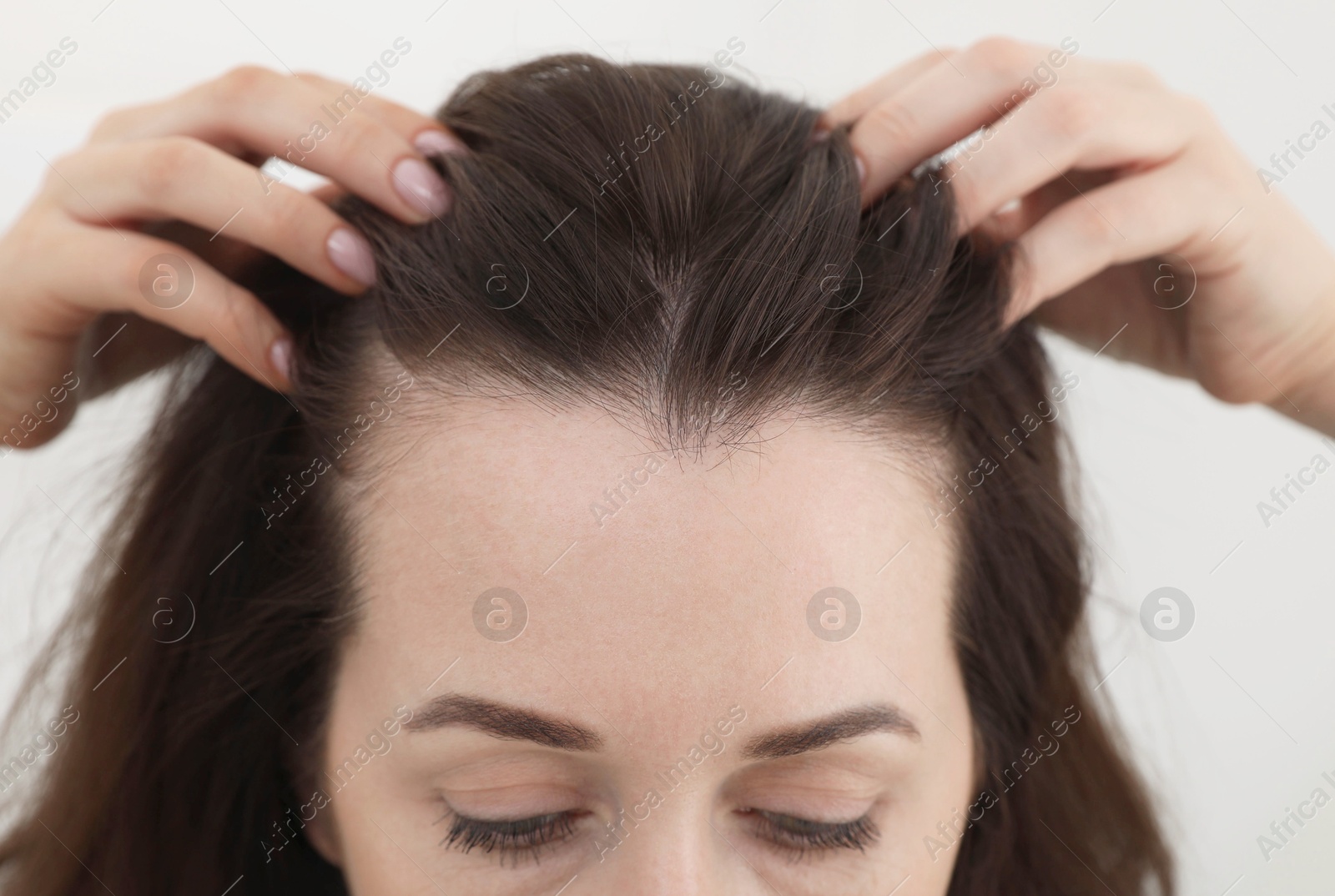 Photo of Woman with hair loss problem at home, closeup