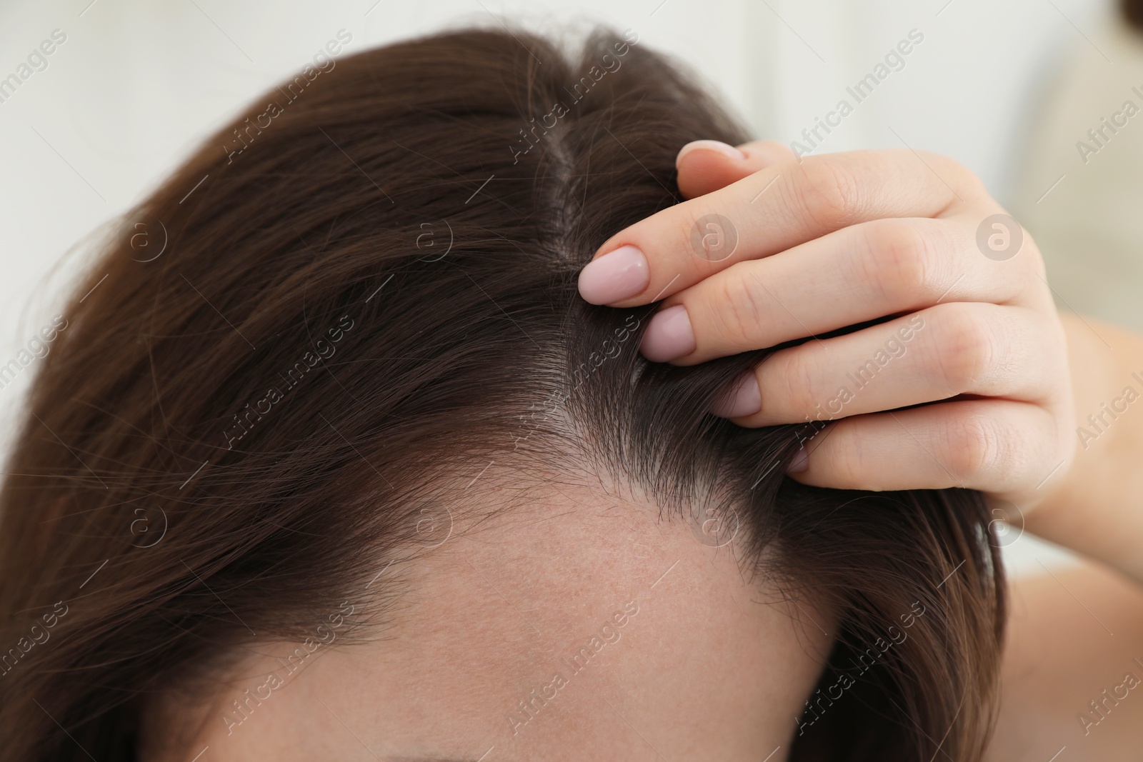 Photo of Woman with hair loss problem at home, closeup