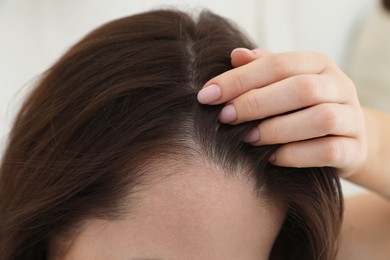 Woman with hair loss problem at home, closeup