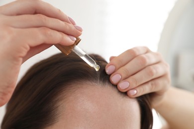 Photo of Hair loss problem. Woman applying serum onto hairline indoors, closeup