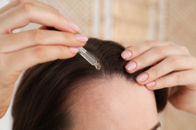 Hair loss problem. Woman applying serum onto hairline indoors, closeup