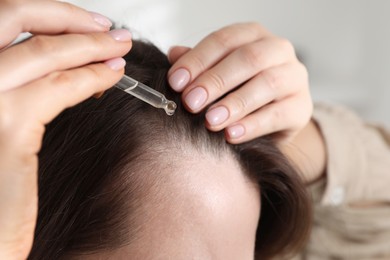 Hair loss problem. Woman applying serum onto hairline indoors, closeup