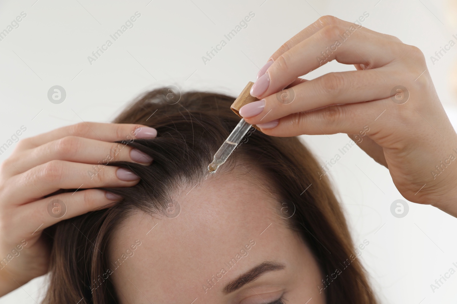 Photo of Hair loss problem. Woman applying serum onto hairline indoors, closeup