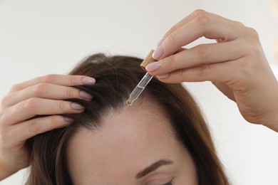 Photo of Hair loss problem. Woman applying serum onto hairline indoors, closeup