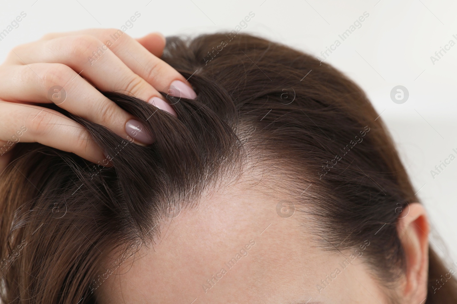 Photo of Woman with hair loss problem at home, closeup