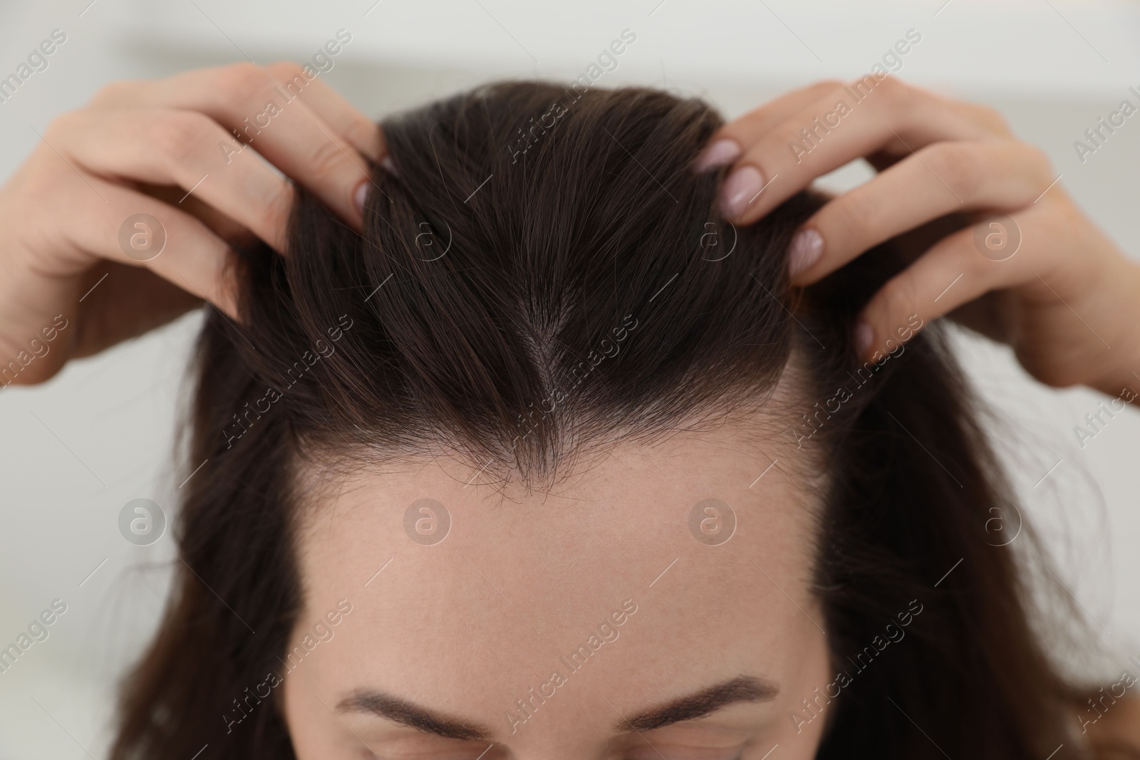 Photo of Woman with hair loss problem at home, closeup