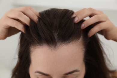 Photo of Woman with hair loss problem at home, closeup