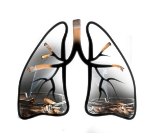 Image of Illustration of lungs with cigarette butts and smoke on white background