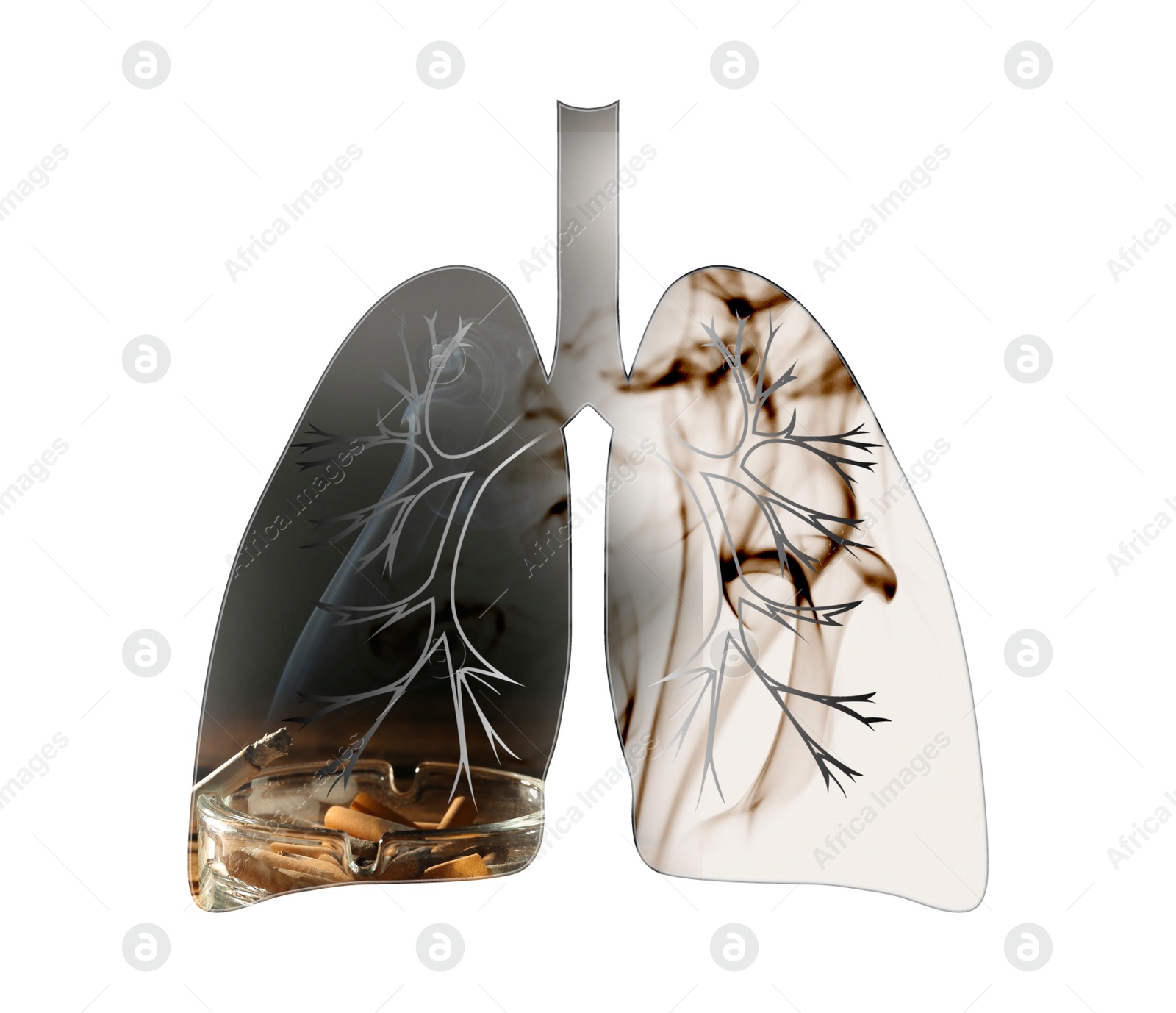 Illustration of  lungs with cigarette butts and smoke on white background