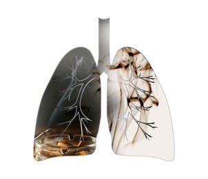 Illustration of  lungs with cigarette butts and smoke on white background