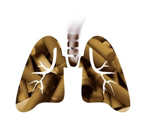 Image of Illustration of lungs with cigarette butts on white background