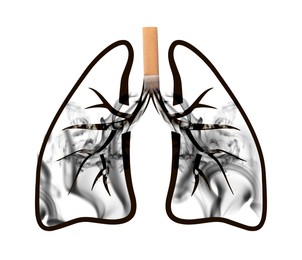 Illustration of lungs with cigarette butt and smoke on white background