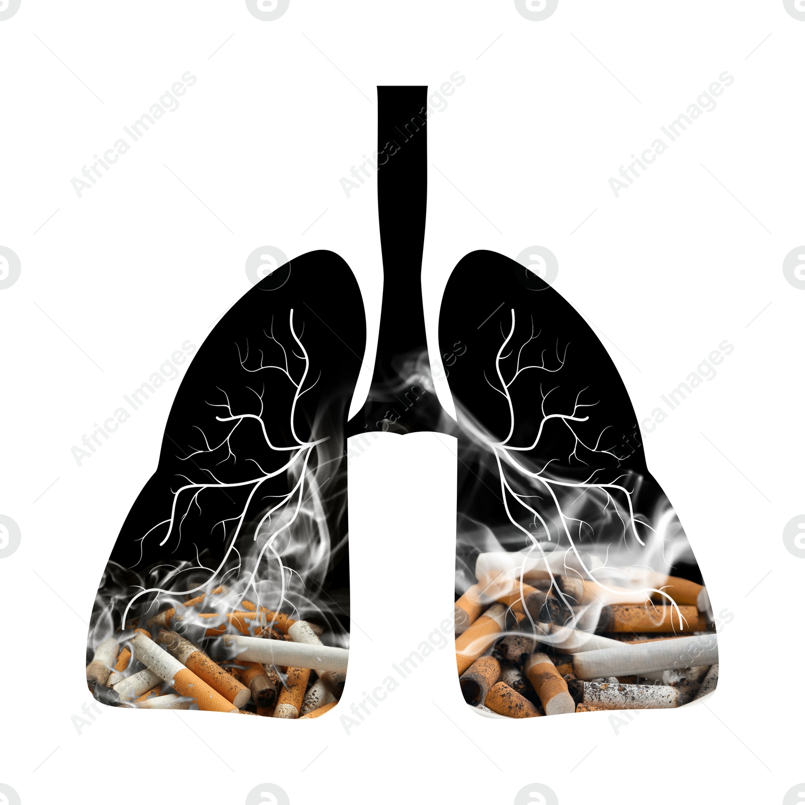 Image of Illustration of lungs with cigarette butts and smoke on white background