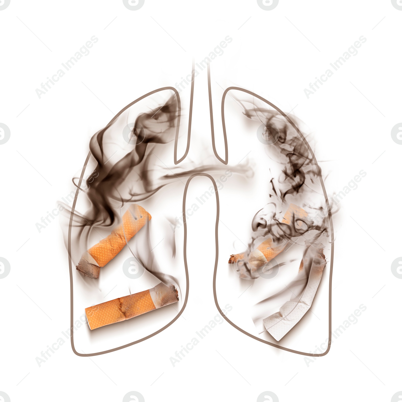 Image of Illustration of lungs with cigarette butts and smoke on white background