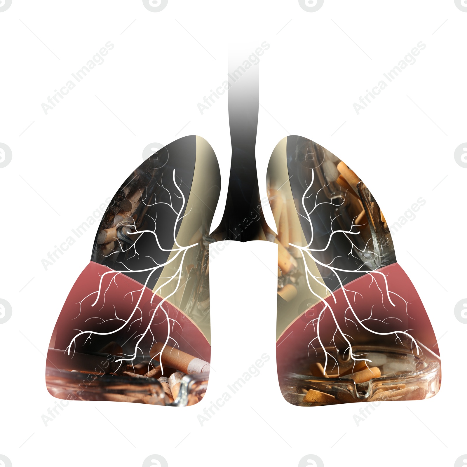 Image of Illustration of lungs with cigarette butts on white background