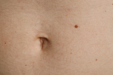 Photo of Woman with birthmark on her skin, closeup