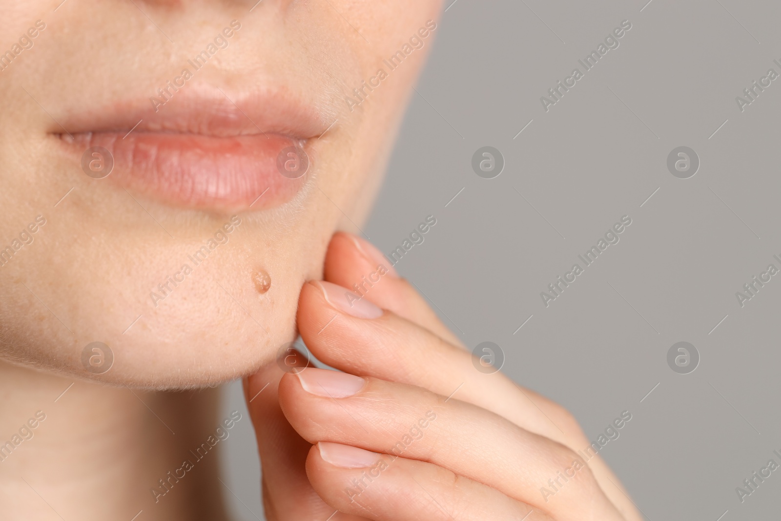 Photo of Woman with mole on her skin against grey background, closeup. Space for text